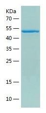 Recombinant Human EIF2B3