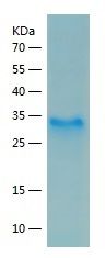 Recombinant Human TFPI
