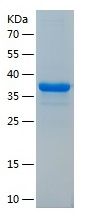 Recombinant Human OGG1