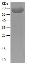 Recombinant Human VISTA
