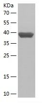 Recombinant Human KLK11