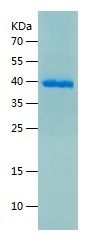 Recombinant Human Carbonic Anhydrase 11