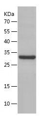 Recombinant Human IgG2 Fc