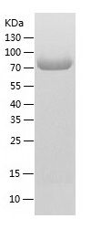 Recombinant Human beta-Glucuronidase