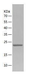 Recombinant Human TFPI-2