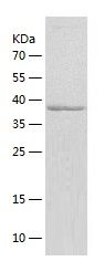 Recombinant Human HABP2