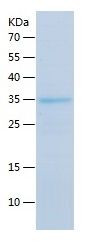 Recombinant Mouse SOST