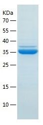 Recombinant Human LMAN2L