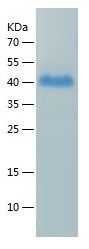 Recombinant Human CXCL16