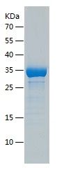 Recombinant Human CCDC134