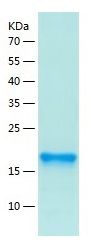 Recombinant Mouse Limitin