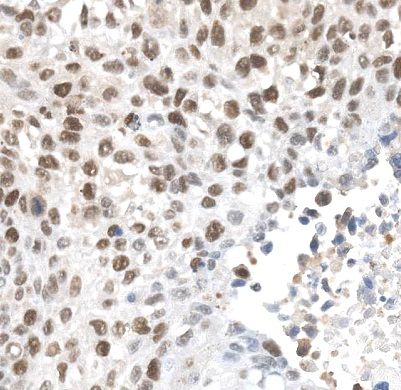 anti- ALKBH5 antibody