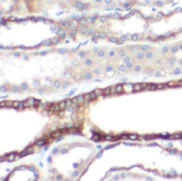 anti- ATP5C1 antibody