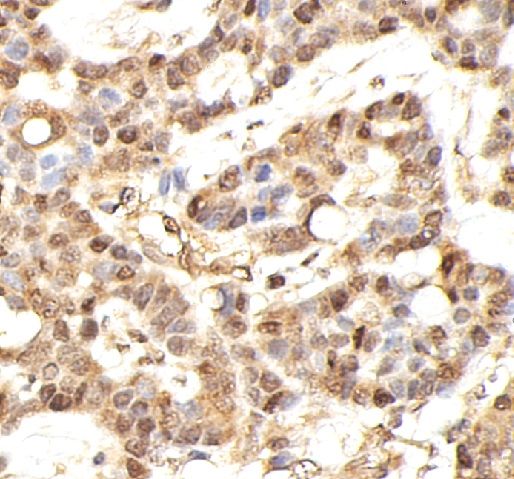 anti- Aurora B antibody