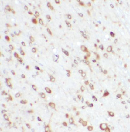 anti- BBS1 antibody