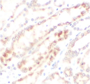 anti- C1orf156 antibody