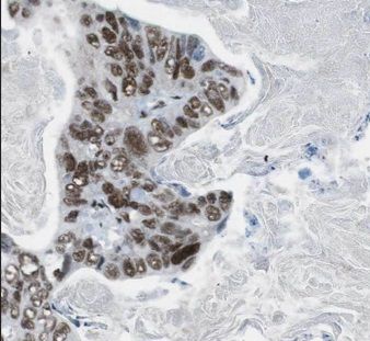 anti- CDCA2 antibody