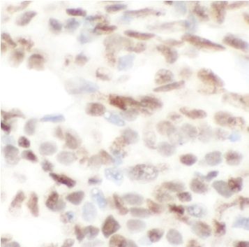 anti- CTBP2 antibody