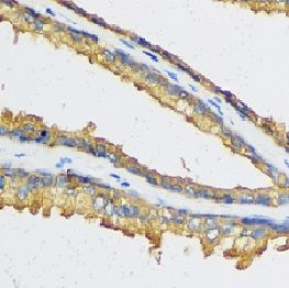 anti- CXCL11 antibody