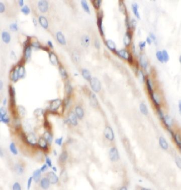 anti- DLAT antibody