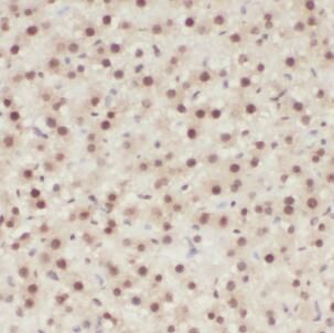 anti- EGR1 antibody