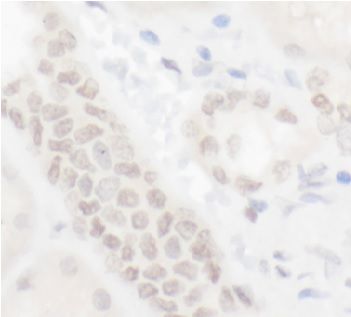 anti- ELF1 antibody