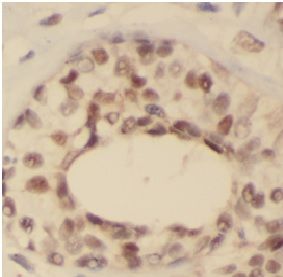 anti- FOXA1 antibody