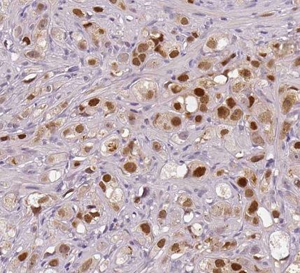     (NR3C1) / anti- Glucocorticoid receptor (NR3C1) antibody