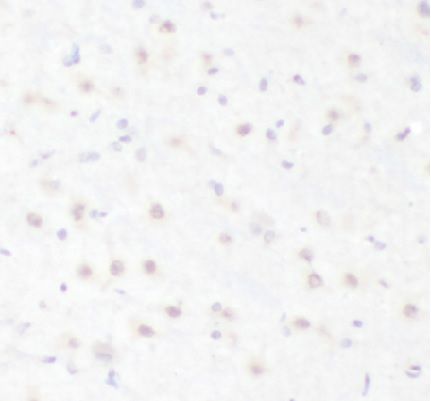 anti- HBG1 antibody