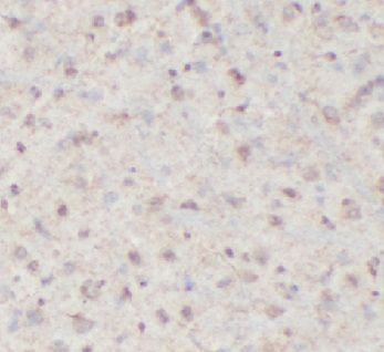 anti- HSP70 antibody