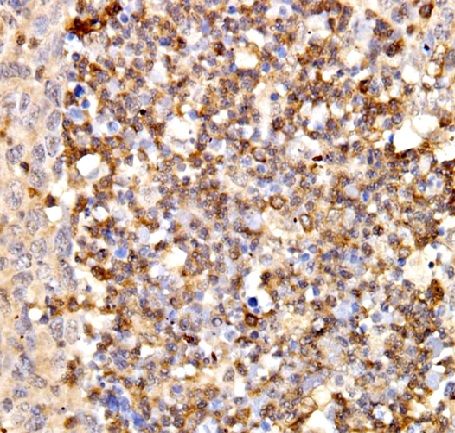 anti- IFIT3 antibody