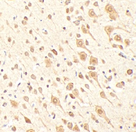 anti- KDM2A antibody