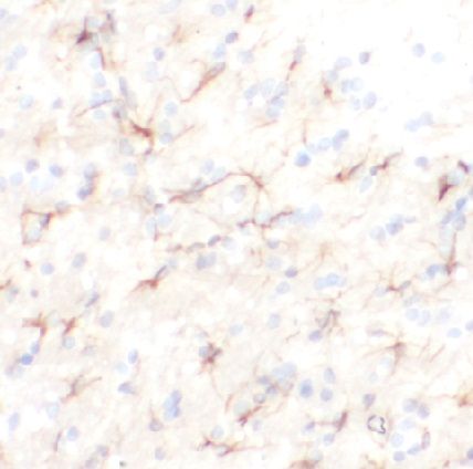 anti- Kv4.1 antibody