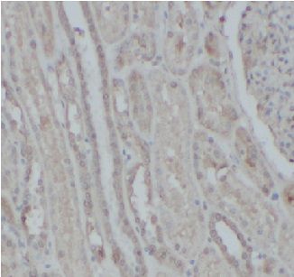 anti- NFKB2 antibody