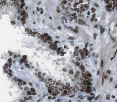 anti- NKX3-1 antibody