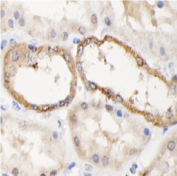 anti- NR1D1 antibody