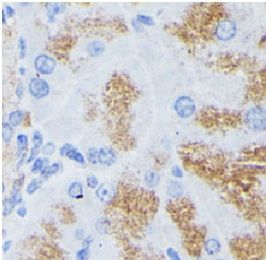 anti- PLA2G1B antibody