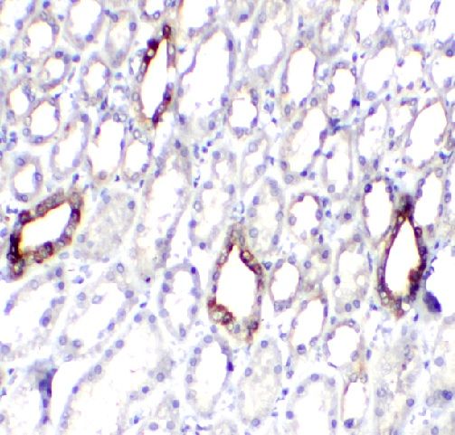 anti- SLCO4C1 antibody