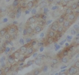 anti- TAX1BP1 antibody