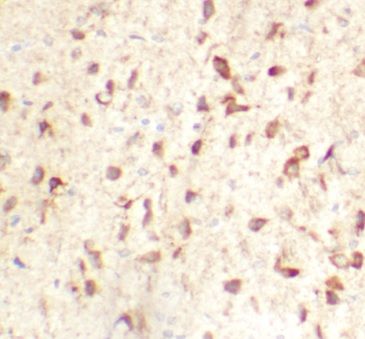 anti- TMEM175 antibody