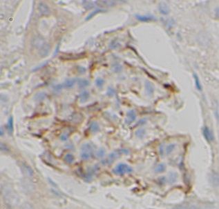 anti- TK2 antibody