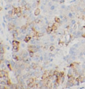 anti- EREG antibody