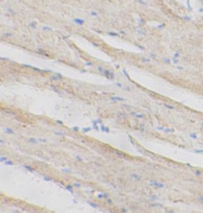  anti- Caspase 3 antibody / anti- Caspase 3 antibody