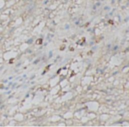  anti- Caspase 1 antibody / anti- Caspase 1 antibody