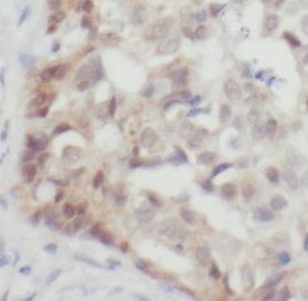 anti- YY1 antibody