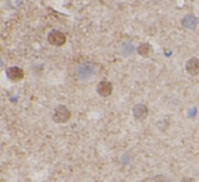 anti- ARFGAP1 antibody