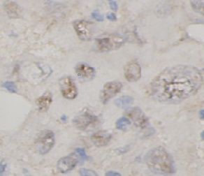 anti- TNFAIP3 antibody