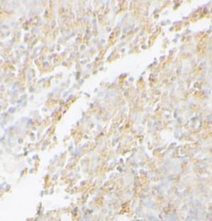 anti- SYWC antibody