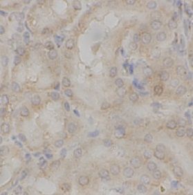 anti- KLF4 antibody