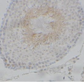 anti- SKP1 antibody